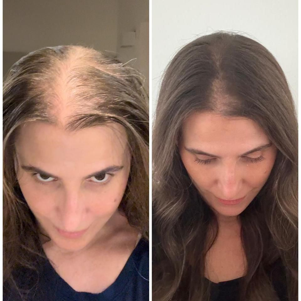 The Hair Generation