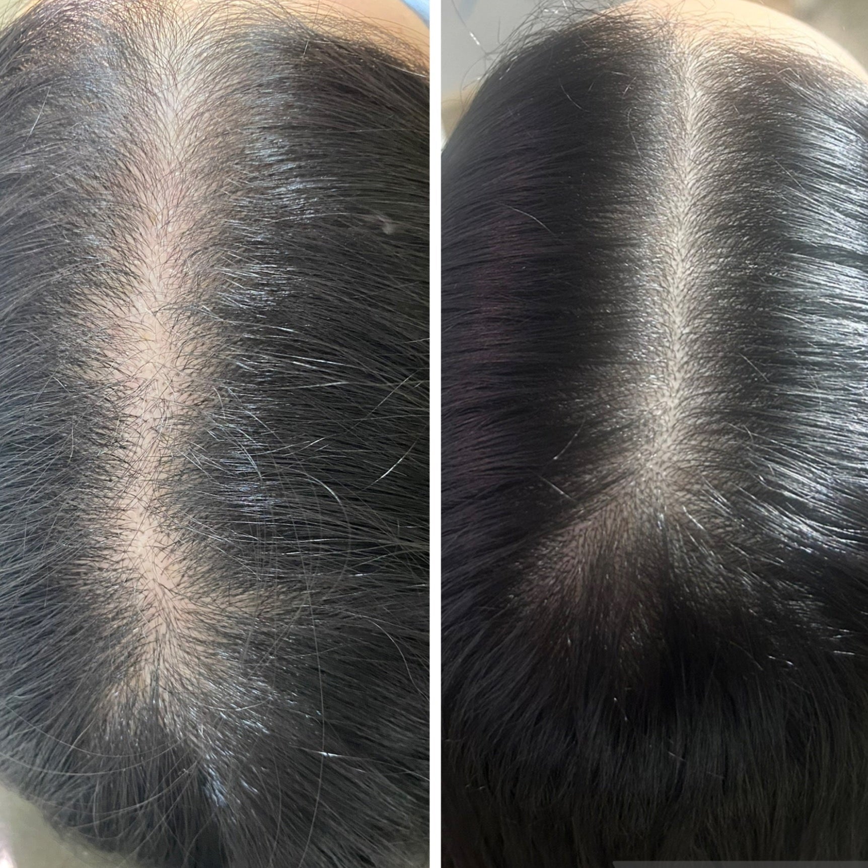 The Hair Generation